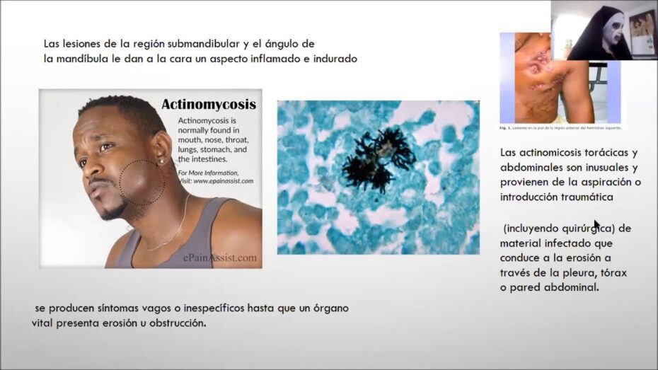 Actinomicetos: Descubre qué son y su importancia en la botánica